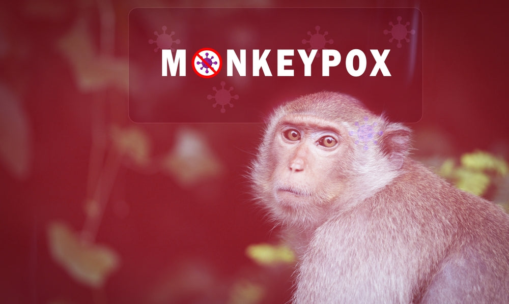 Monkeypox: What It Is and the Harm It Is Causing to Our LGBTQIA+ Community